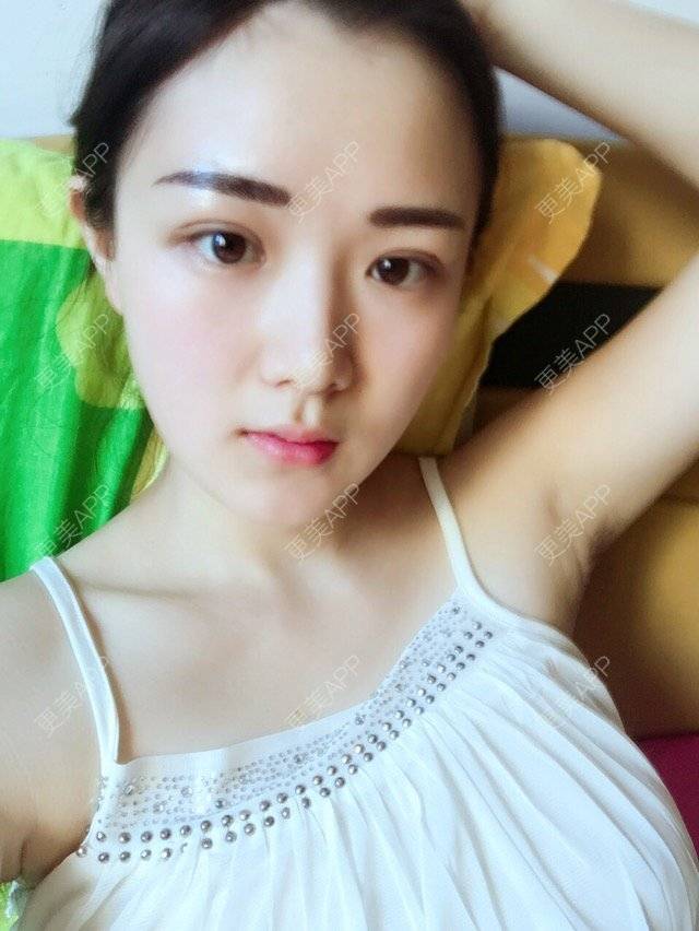埋线双眼皮 韩式半永久眉毛 双眼皮 沈阳
