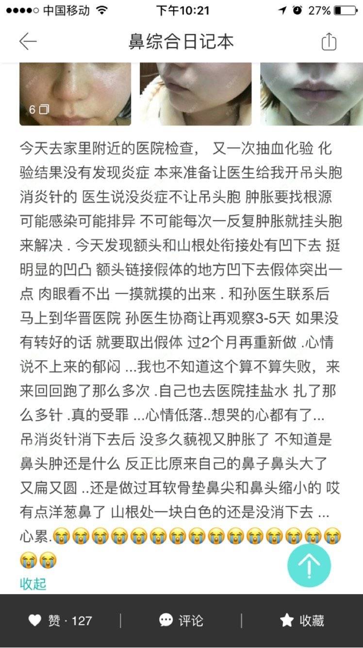 J-King小时侯的更美日记