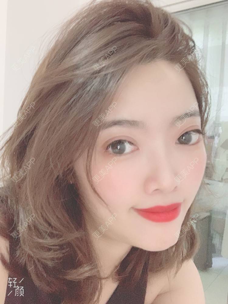 王兜兜兜兜的全切双眼皮日记