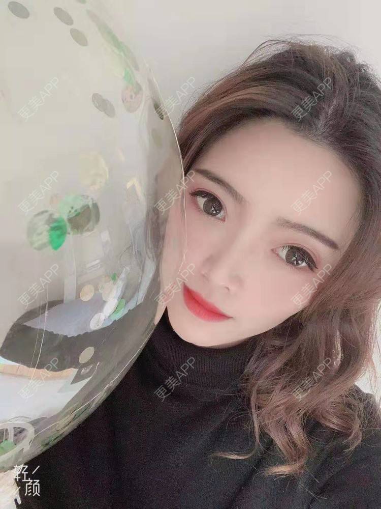 王兜兜兜兜的全切双眼皮日记