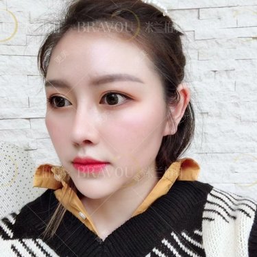 宋子杰整形医生_宋子杰主页_更美app官网