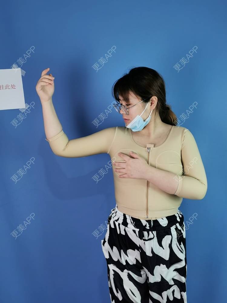 昵称也太多重复了吧的吸脂去副乳日记