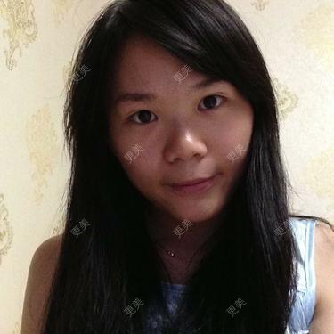 鼻部多项