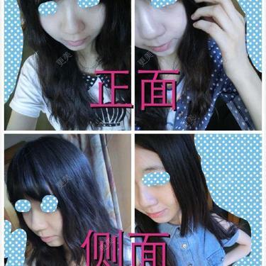 鼻部多项