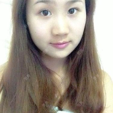 鼻翼