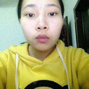 鼻翼