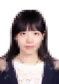 双眼皮