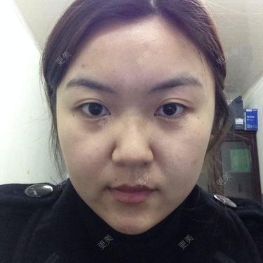 鼻部多项