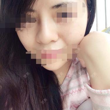 鼻部多项