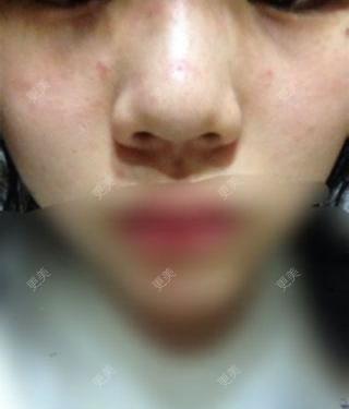皮肤问题
