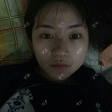 下巴