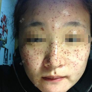 美白嫩肤