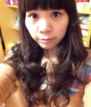 太阳穴