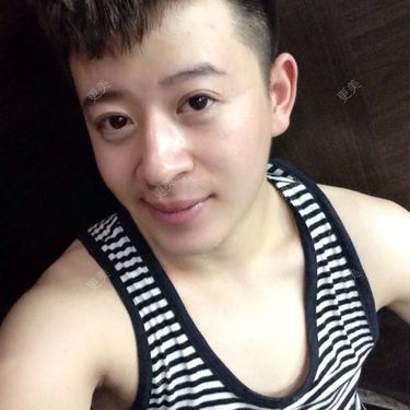 开眼角