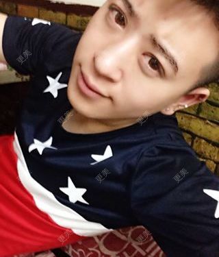 开眼角