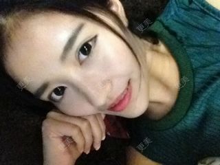 颧骨颧弓