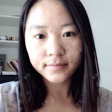 牙齿整形