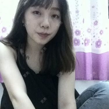 牙齿整形