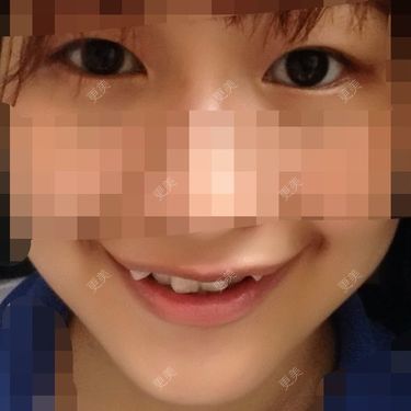 牙齿整形