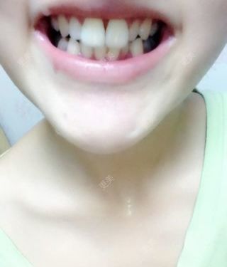 口腔其他