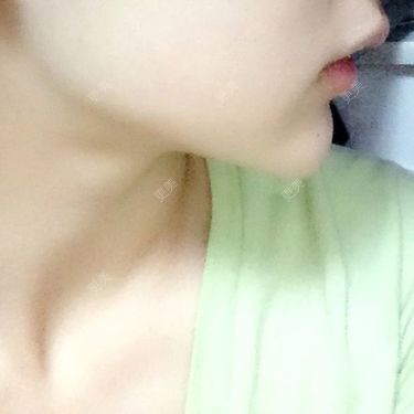 口腔其他