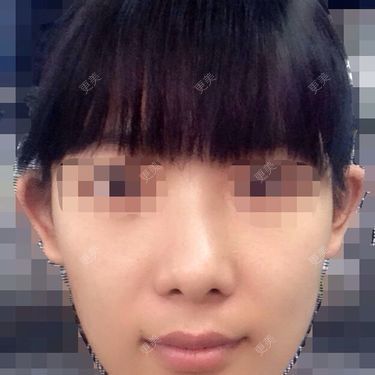 耳部其他