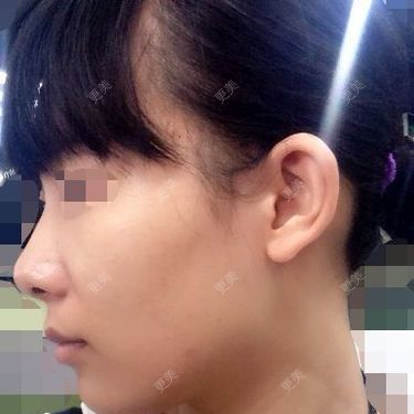 耳部其他