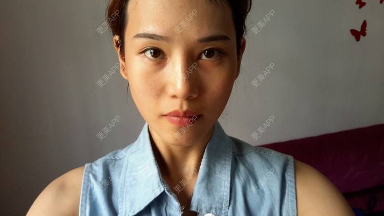 更美 - 超级差的皮肤，该做些什么之治疗才能改善点呢？ | 美白嫩肤 | 南宁