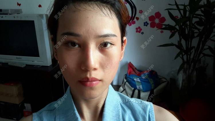 更美 - 超级差的皮肤，该做些什么之治疗才能改善点呢？ | 美白嫩肤 | 南宁