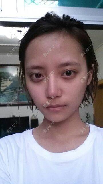 更美 - 需要调整一下哪里，感觉这个张脸穿什么都丑，好绝望。。。 | 填充卧蚕 | 临沧 | 热门讨论