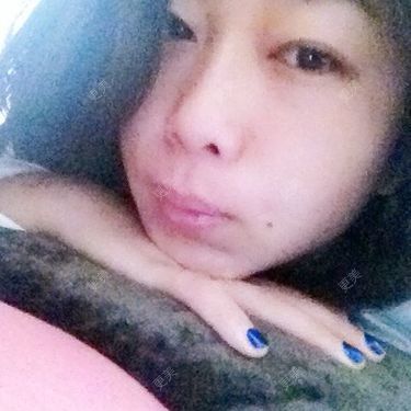 眼部修复