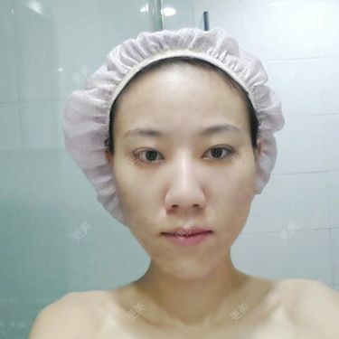 口腔其他