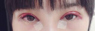双眼皮