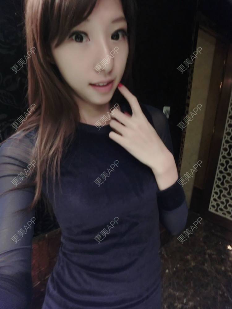 喵喵ccat的整形分享【多图】_更美app官网