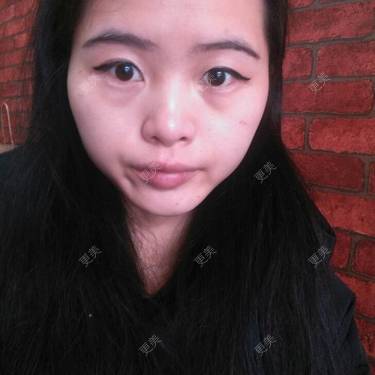 小鱼儿