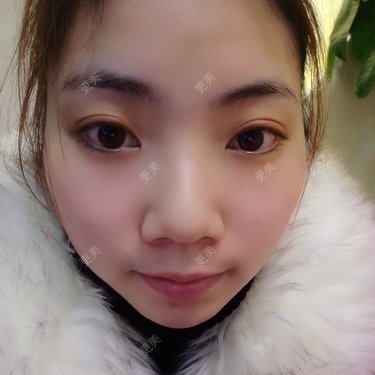 葡萄kiss
