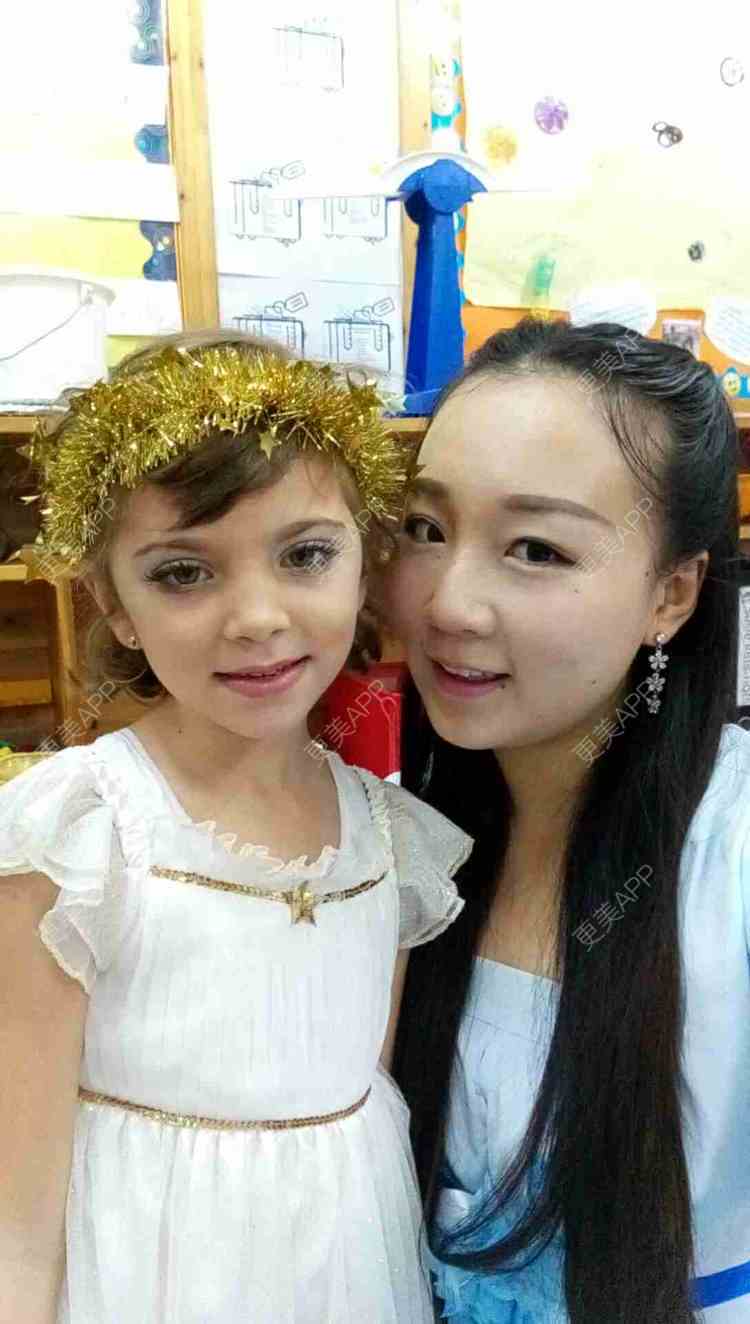 更美 - 双下巴激光溶脂+激光溶脂瘦脸 | 双下巴溶脂 | 激光溶脂瘦脸 | 深圳