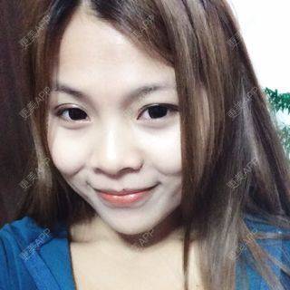 更美 - 自体脂肪隆鼻的日记 | 自体脂肪隆鼻 | 西安