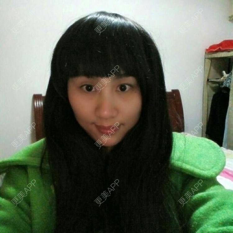 更美 - 玻尿酸隆鼻+激光脱发际线+睫毛移植 | 玻尿酸鼻部 | 激光脱发际线 | 长沙