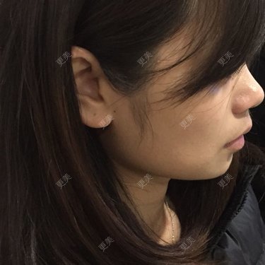 Anna要上进