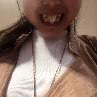 美容冠