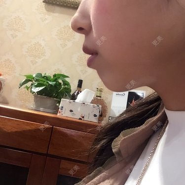 美容冠