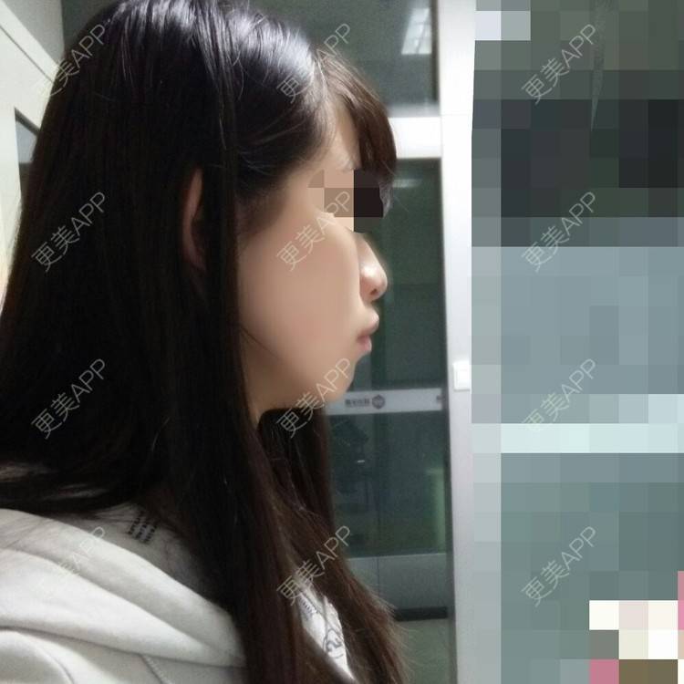 更美 - I'm Lucy的经验 | 下巴 | 洛阳