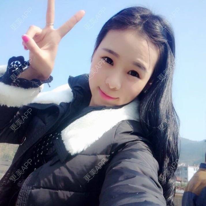 更美 - ◆ Ｖｉｋｉ－ｊｊ的经验 | 太阳穴 | 台州