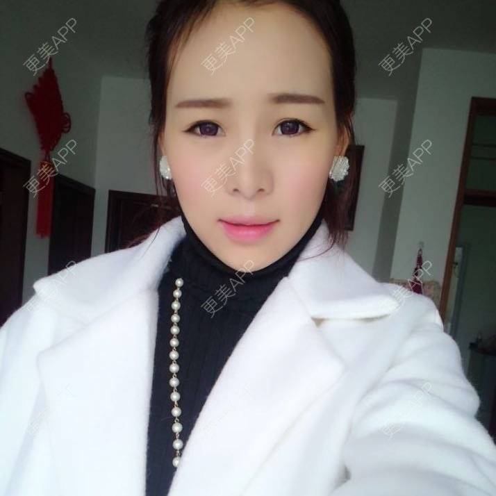 更美 - ◆ Ｖｉｋｉ－ｊｊ的经验 | 太阳穴 | 台州