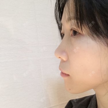 Change_3