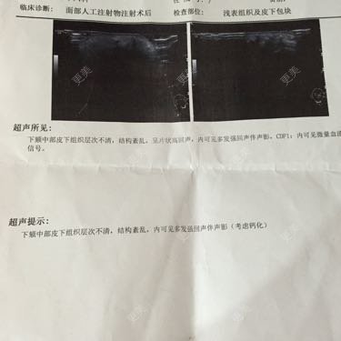 下巴