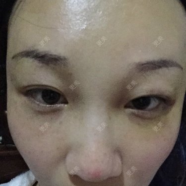 皇小贝
