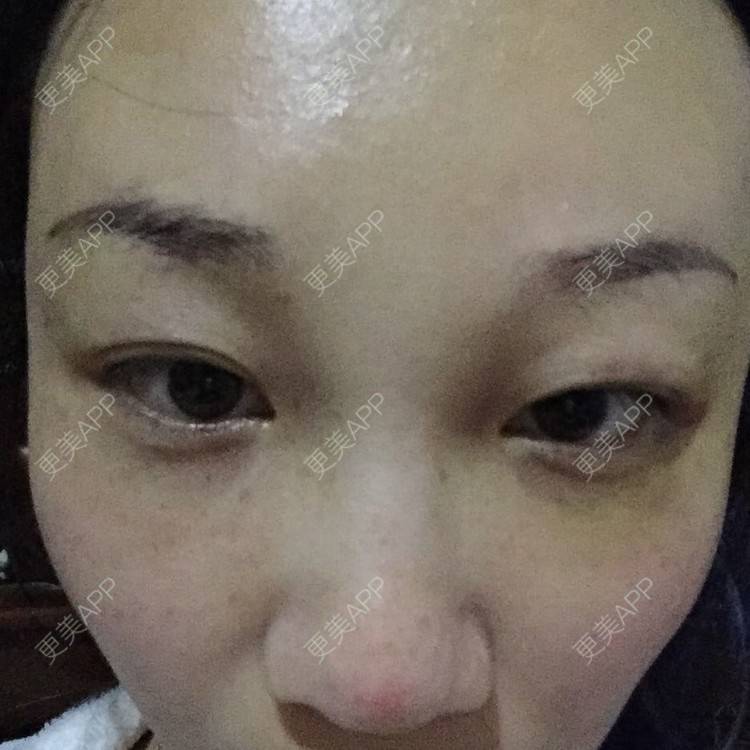 更美 - 皇小贝的经验 | 额头 | 南京