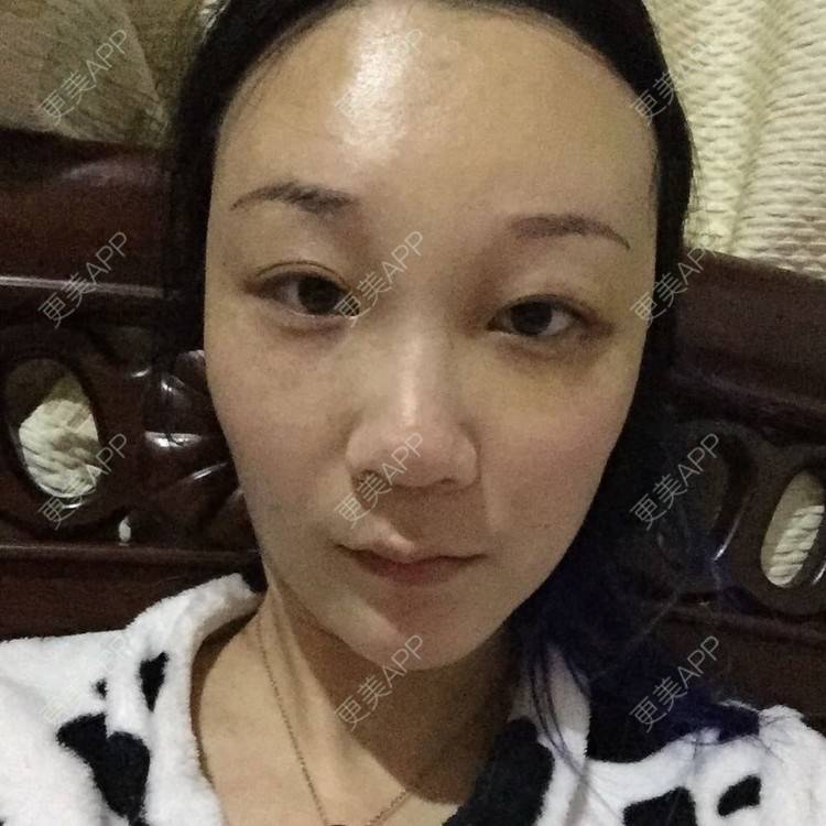 更美 - 皇小贝的经验 | 额头 | 南京